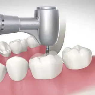 Screenshot from Optio Dentistry video